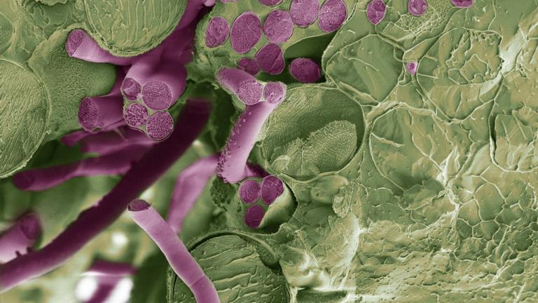 1024_x_709_-_microdochium_mycelium_growing_thorugh_the_leaf.jpg