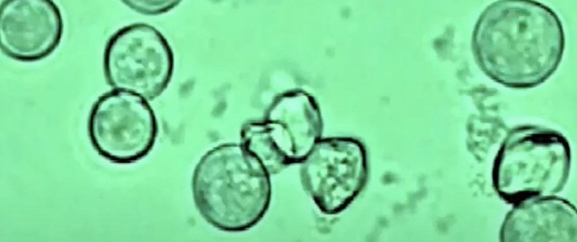 Medallion turf Disease Image