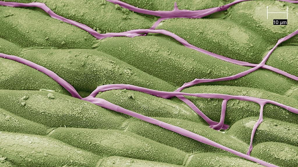 Hyphae entering stomata