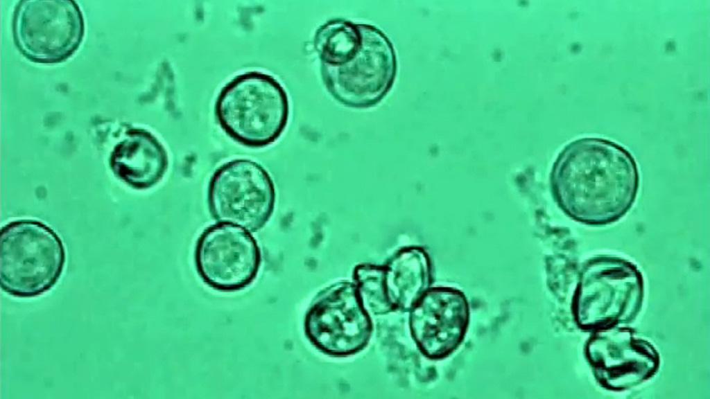 Disease spores exploding on contact with  fludioxonil in Medallion TL