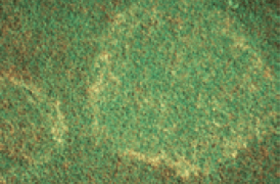 haxringar