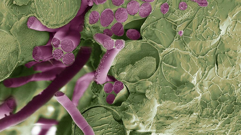 Disease fungal hyphae in leaf
